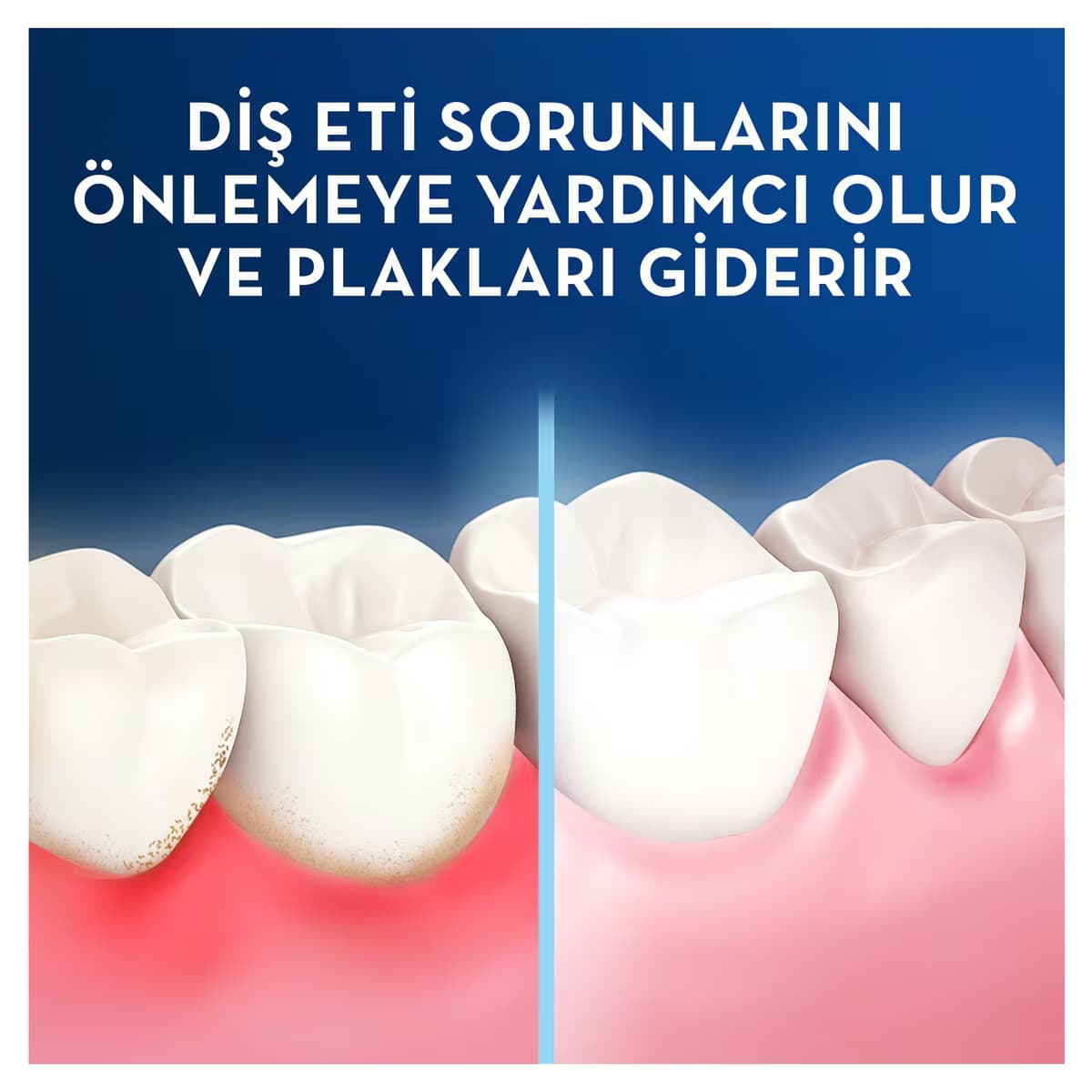 Oral-B Pro Expert Diş İpi 25 m 5
