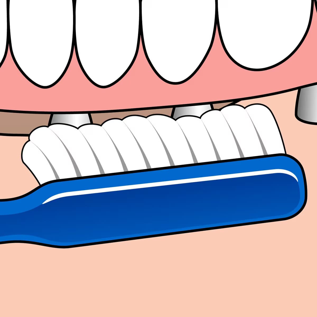 Tepe Diş Fırçası Implant Ortodontik 1 adet 3