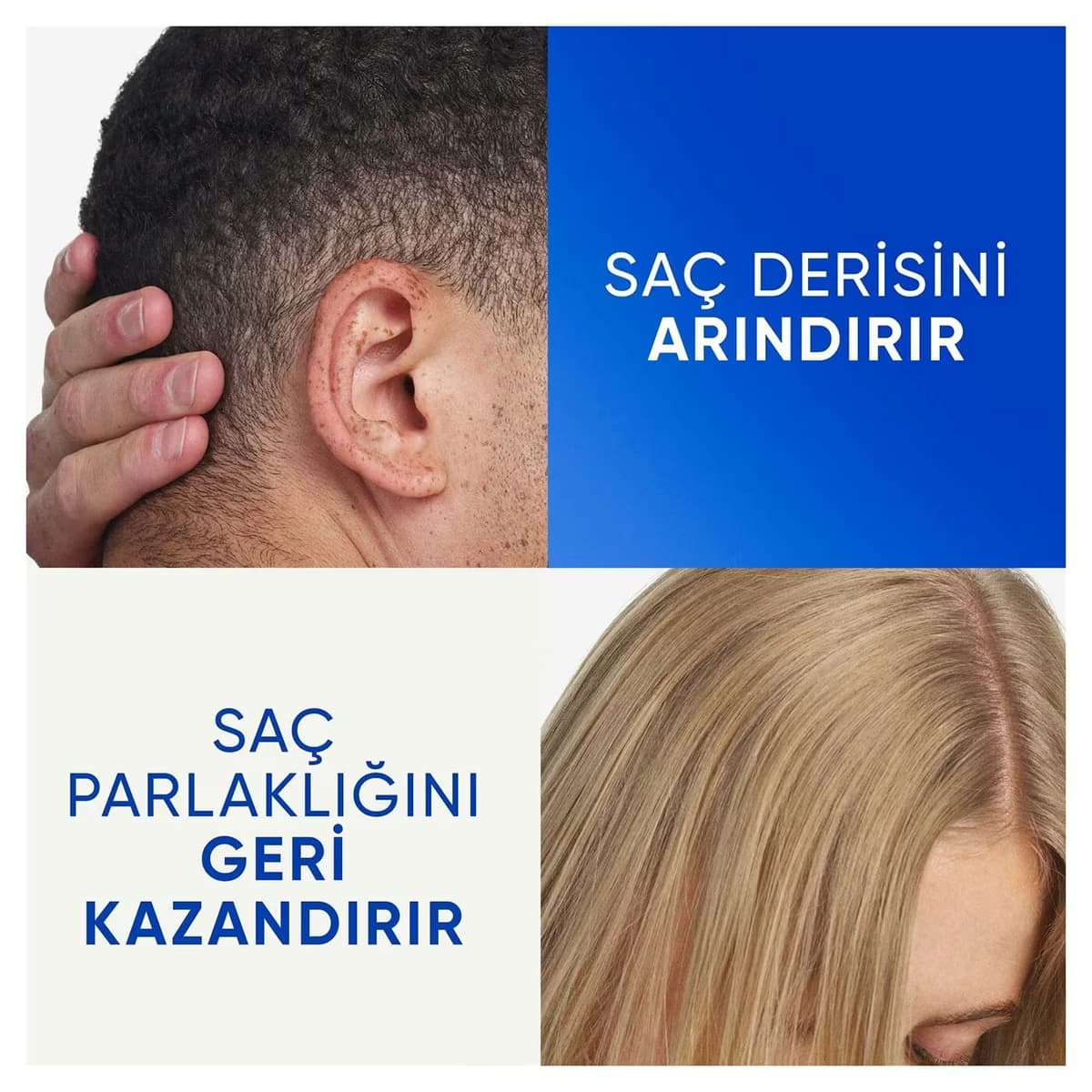 Head&Shoulders Şampuan Elma Sirkeli 330 ml 5