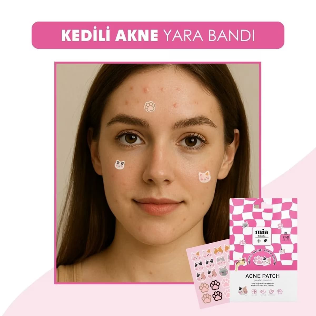 Mia Klinika Akne Bandı Kedili 20'li 3