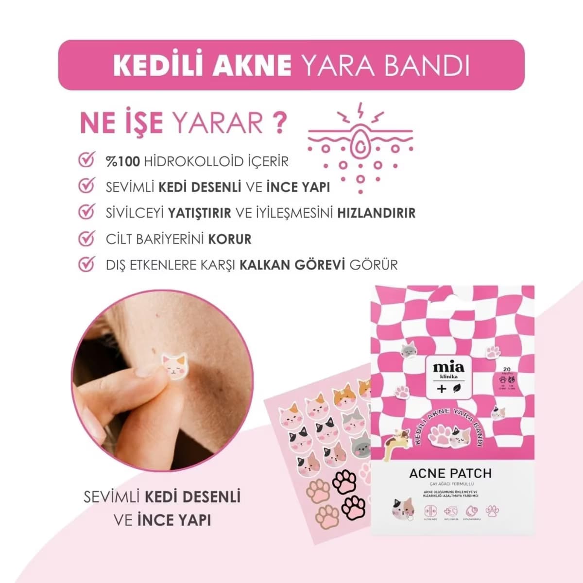 Mia Klinika Akne Bandı Kedili 20'li 4