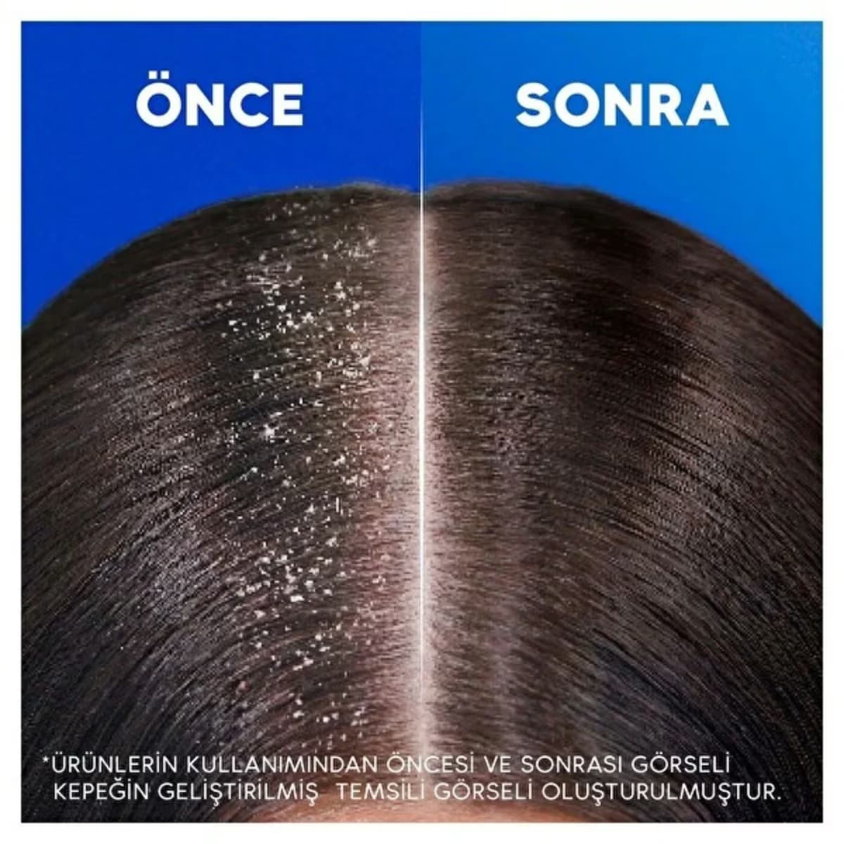 Head&Shoulders Şampuan Klasik Bakım 330 ml 4